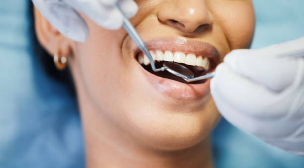Best Pediatric Emergency Dentist in Brownfields, LA